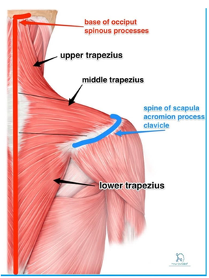 trapezius tear signs symptoms